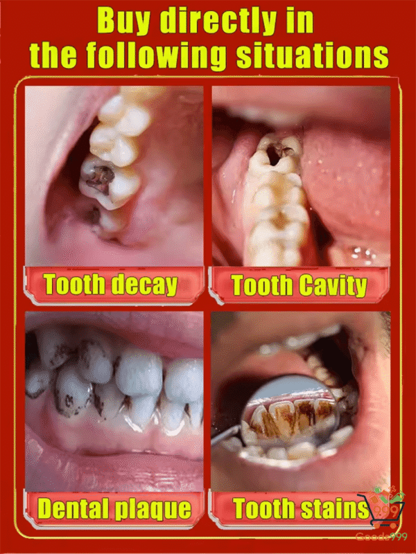 Repair tooth